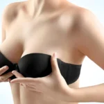 Things You Need to Know About Breast Reduction Surgery