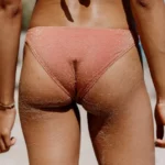 Tips for Treating and Preventing Butt Acne