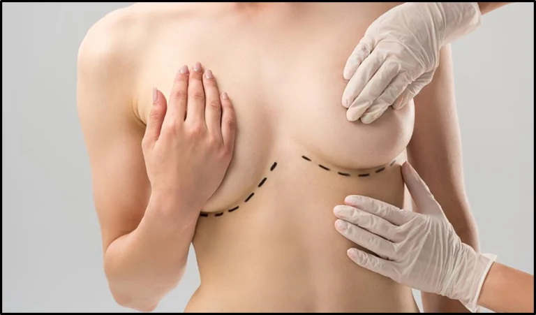 How to Address Health Concerns Related to Excessively Large Breasts?