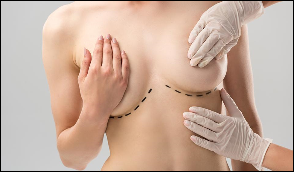 How to Address Health Concerns Related to Excessively Large Breasts?